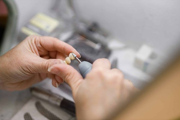 Welche sind die Anzeichen, dass mein Kaninchen zu lange Zähne hat, und wie kann man sie kürzen?